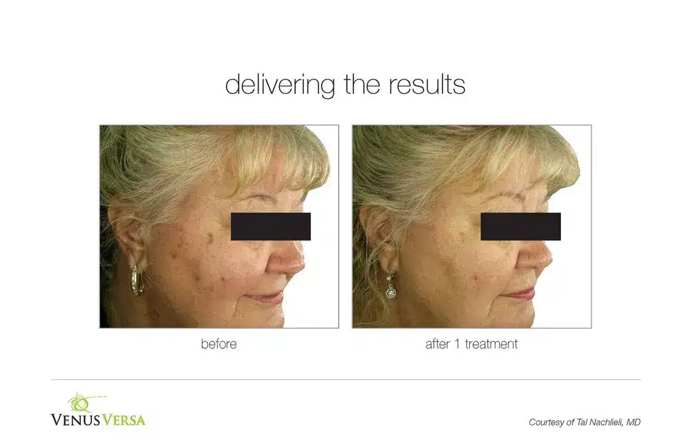 VVE_SR_3.jpg VVE SR 3.jpg