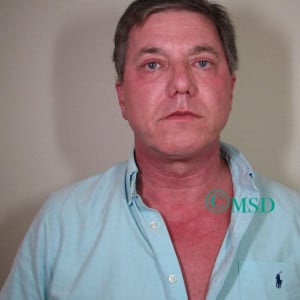 Before Image: Advalight B&A - front