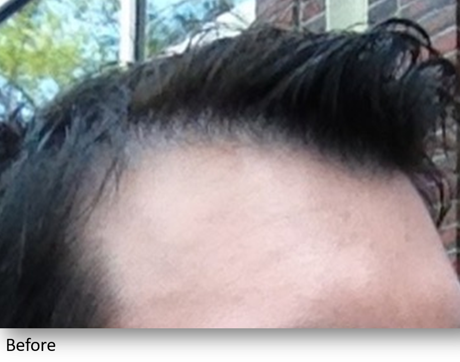 Before Image: Keralase - right-front-oblique
