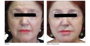 1772095986_VenusViva_B-5-1-300x155 1772095986 VenusViva B 5 1 300x155 1