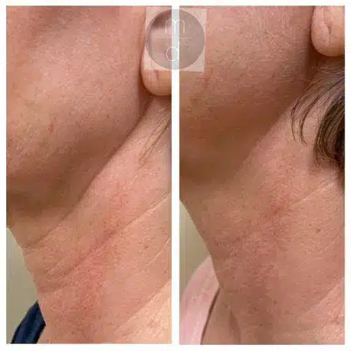 1-1-1-1.jpg 1 1 1 1.jpg