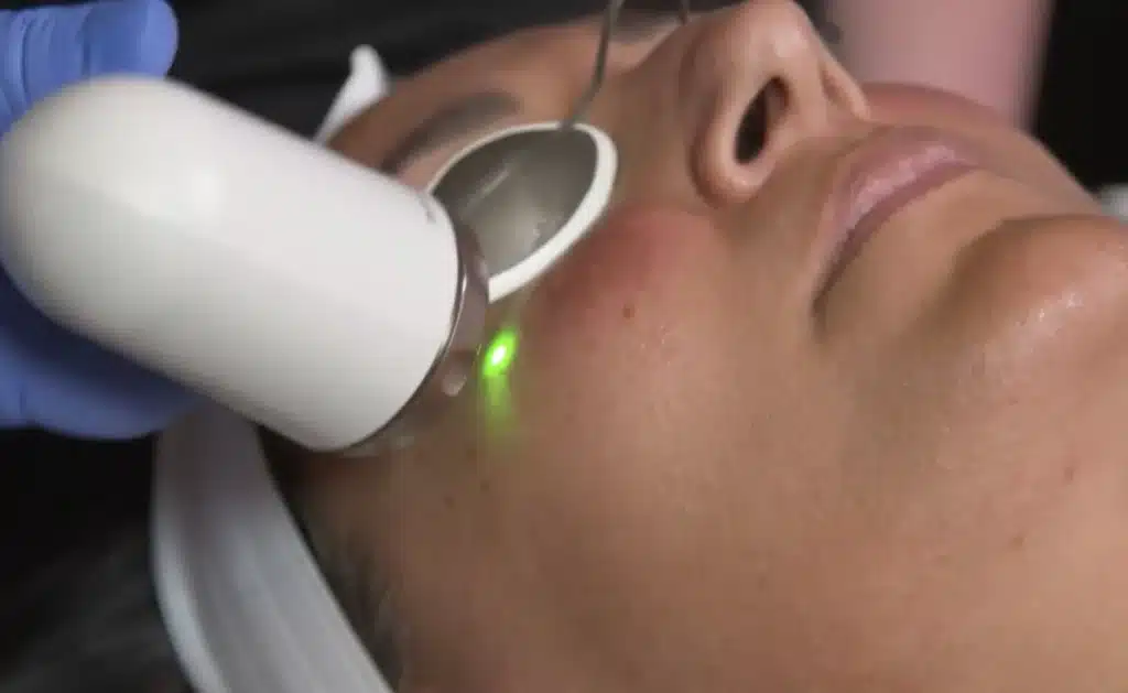 ADVATx Treatment04.jpg