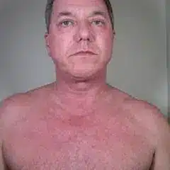 Before1 1 e1598016060272.jpg